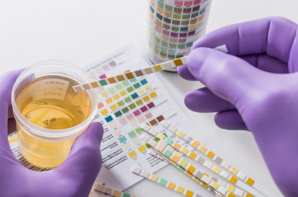 All You Need to Know about Urine Temperature for Drug Test